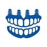 Dental Implants Before and After
